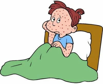 varicella1 varicella1